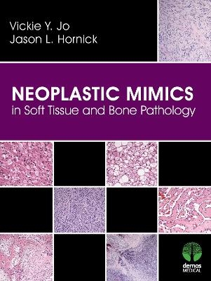 Neoplastic Mimics in Soft Tissue and Bone Pathology - Vickie Y. Jo, Jason L. Hornick