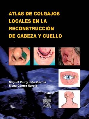 Atlas de Colgajos Locales En La Reconstrucción de Cabeza Y Cuello - Miguel Burgueño García, Elena Milagros Gómez García