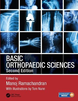 Basic Orthopaedic Sciences - 