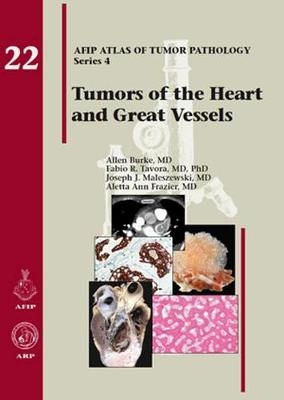 Tumors of the Heart and Great Vessels - Allen Burke, Fabio R. Tavora, Joseph J. Maleszewski, Aletta Ann Frazier