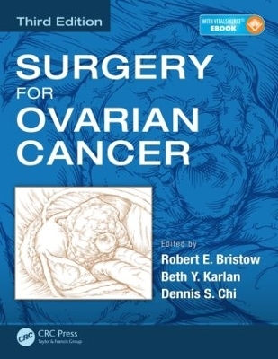 Surgery for Ovarian Cancer - 