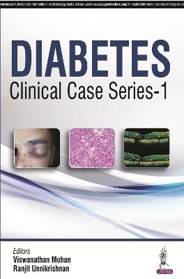 Diabetes Clinical Case Series – 1 - V Mohan, Ranjit Unnikrishnan