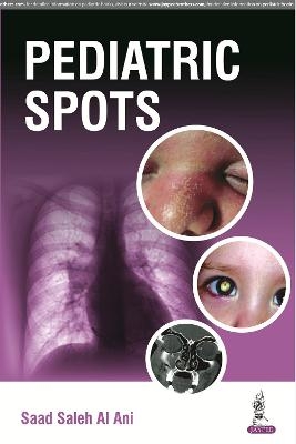 Pediatric Spots - Saleh Saad Al Ani