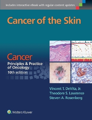 Cancer of the Skin - Vincent T DeVita  Jr., Theodore S. Lawrence, Steven A. Rosenberg