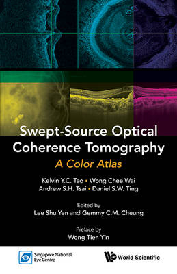 Swept-source Optical Coherence Tomography: A Color Atlas - Kelvin Yi Chong Teo, Chee Wai Wong, Andrew Shih Hsiang Tsai