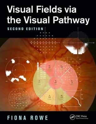 Visual Fields via the Visual Pathway - Fiona Rowe