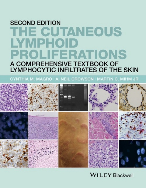 Cutaneous Lymphoid Proliferations - Cynthia M. Magro, A. Neil Crowson, Martin C. Mihm