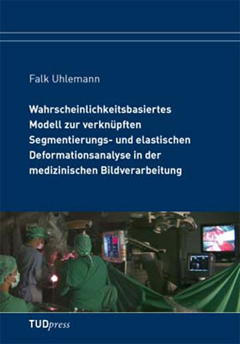 Wahrscheinlichkeitsbasiertes Modell zur verknüpften Segmentierungs- und elastischen Deformationsanalyse in der medizinischen Bildverarbeitung - Falk Uhlemann