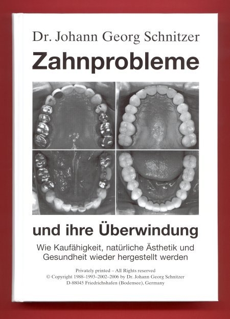 Zahnprobleme und ihre Überwindung - Johann G Schnitzer