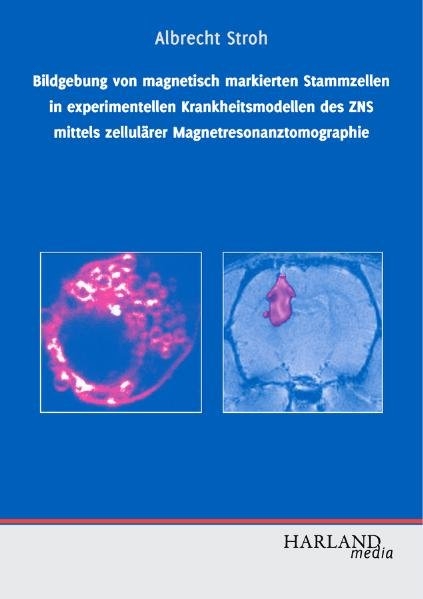 Bildgebung von magnetisch markierten Stammzellen in experimentellen Krankheitsmodellen des ZNS mittels zellulärer Magnetresonanztomographie - Albrecht Stroh