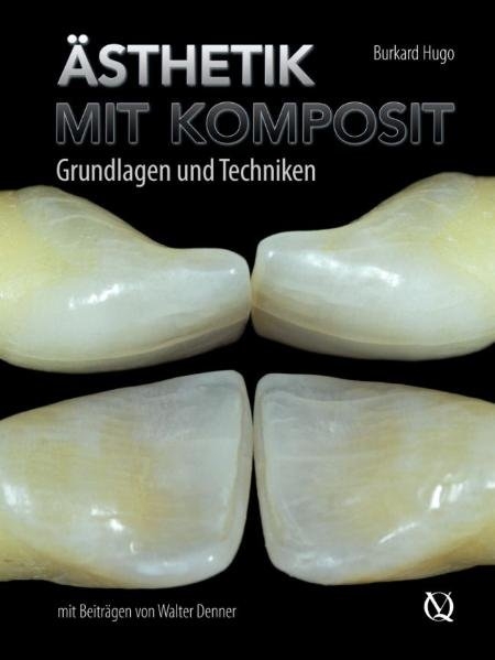 Ästhetik mit Komposit - Burkard Hugo