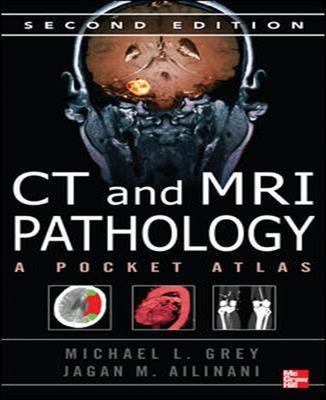 CT & MRI Pathology: A Pocket Atlas, Second Edition (Int'l Ed) - Michael Grey, Jagan Ailinani