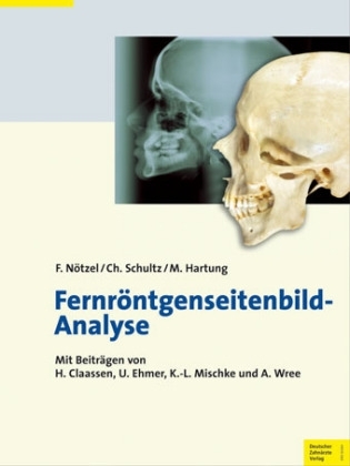 Fernröntgenseitenbild-Analyse - Frank Nötzel