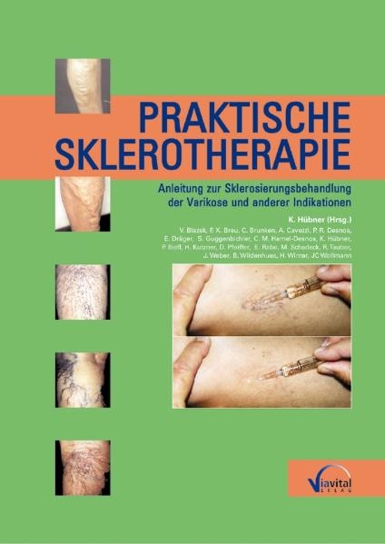 Praktische Sklerotherapie - 