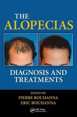 The Alopecias - 