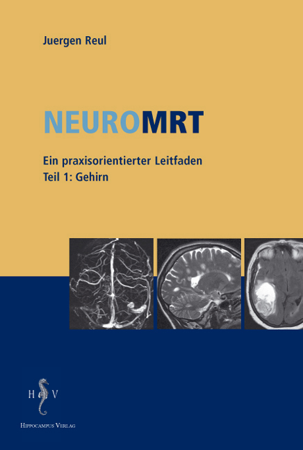 NeuroMRT - Juergen Reul