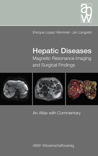 Hepatic Diseases - Enrique Lopez Hänninen, Jan Langrehr