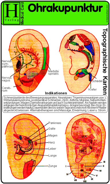 Ohrakupunktur - Medical Card