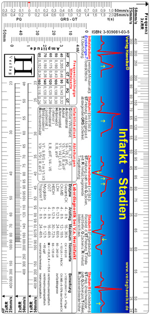 EKG Lineal - Infarkt