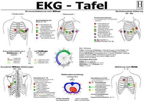 EKG Tafel