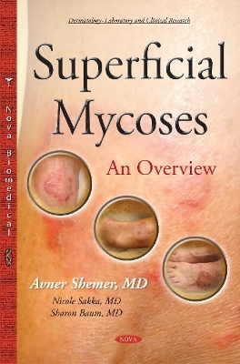 Superficial Mycoses - Avner Shemer, Nicole Sakka, Sharon Baum