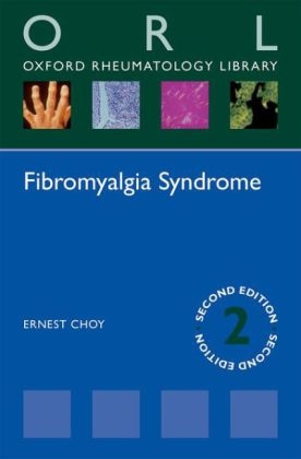 Fibromyalgia Syndrome - Ernest Choy