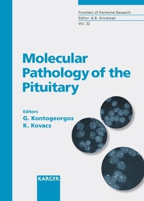 Frontiers of Hormone Research / Molecular Pathology of the Pituitary - 