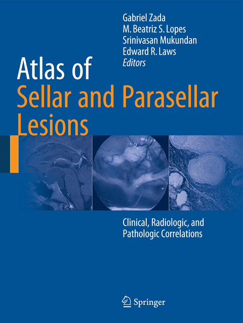 Atlas of Sellar and Parasellar Lesions - 