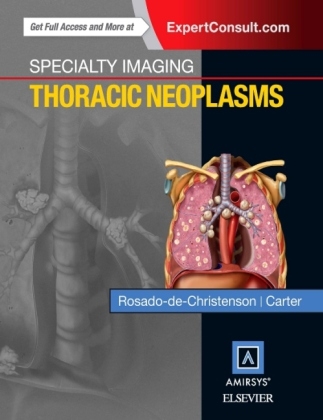 Specialty Imaging: Thoracic Neoplasms - Melissa L. Rosado-de-Christenson, Brett W. Carter