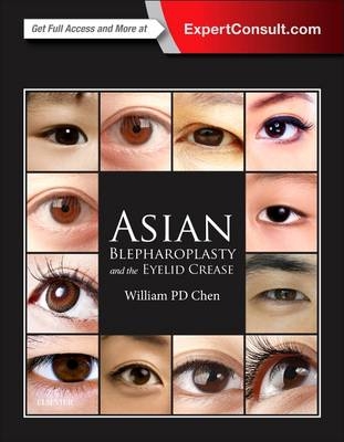 Asian Blepharoplasty and the Eyelid Crease - William P. Chen