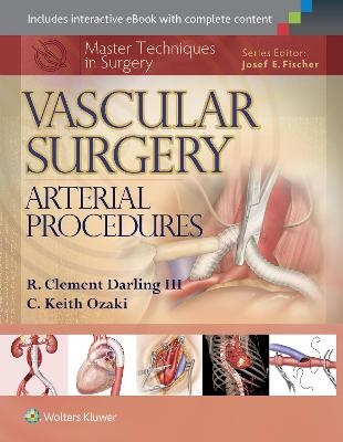 Master Techniques in Surgery: Vascular Surgery: Arterial Procedures - R. Clement Darling, C. Keith Ozaki