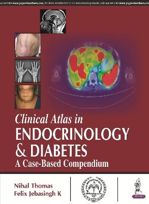 Clinical Atlas in Endocrinology & Diabetes - 