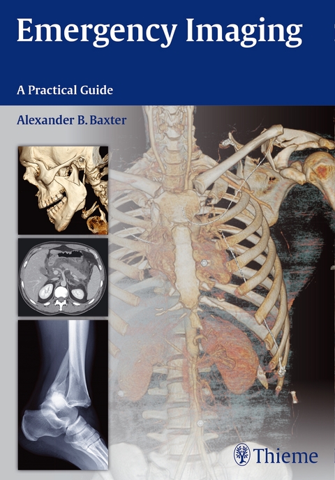 Emergency Imaging - Alexander B Baxter, Trudy Cloyd