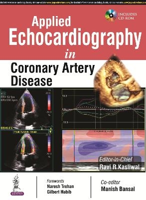 Applied Echocardiography in Coronary Artery Disease - RR Kasliwal