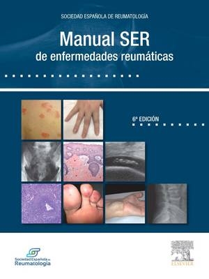 Manual Ser de Reumatolog�a -  ser