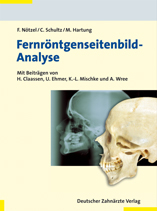 Fernröntgenseitenbild-Analyse - Frank Nötzel, Christian Schultz, Matthias Hartung