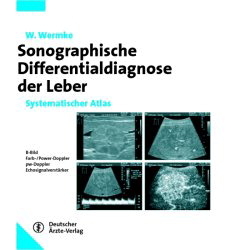 Sonographische Differenzialdiagnose
Leberkrankheiten