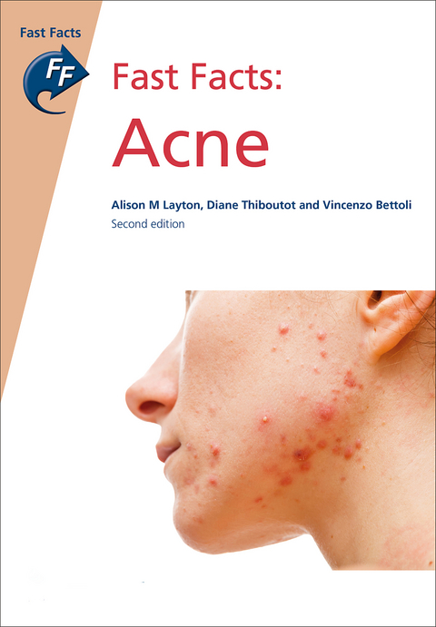 Fast Facts: Acne - Alison M Layton, Diane Thiboutot, Vincenzo Bettoli