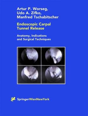 Endoscopic Carpal Tunnel Release - Artur P. Worseg, Udo A. Zifko, Manfred Tschabitscher