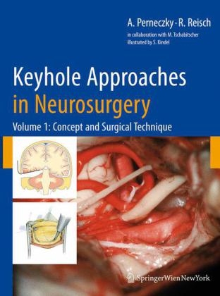 Keyhole Approaches in Neurosurgery - Axel Perneczky, Robert Reisch