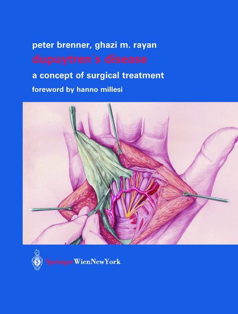 Dupuytren’s Disease - Peter Brenner, Ghazi M. Rayan