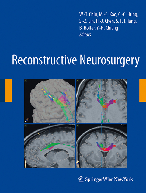 Reconstructive Neurosurgery - 