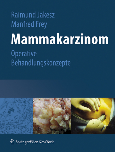 Mammakarzinom - 