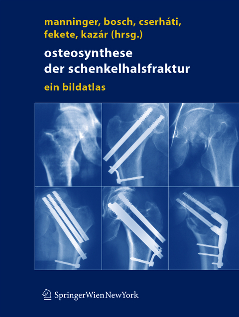 Osteosynthese der Schenkelhalsfraktur - 