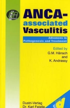 ANCA-associated Vasculitis Advances in Pathogenesis and Treatment - 