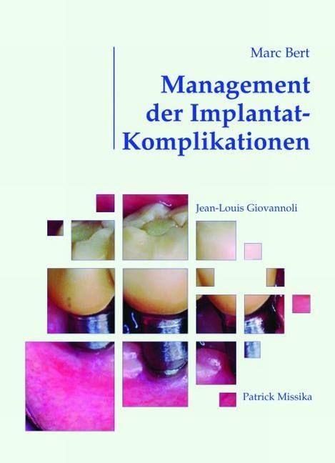 Management der Implantat-Komplikationen - Marc Bert, Patrick Missika, Jean L Giovannoli