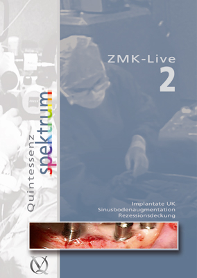 ZMK-Live 2 - G. Basting