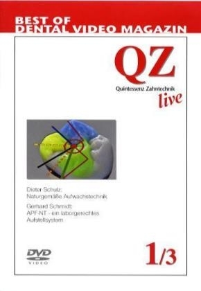 Quintessenz Zahntechnik live, 1 DVD. Tl.1