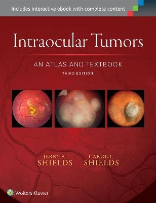 Intraocular Tumors: An Atlas and Textbook - Dr. Jerry A. Shields, Dr. Carol L. Shields