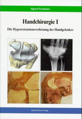 Handchirurgie - Sigurd Pechlaner